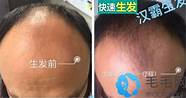 古方生发液怎么样与古方