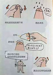 怎么样算包皮过长与包皮