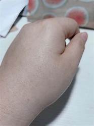 薇姿祛斑效果怎么样 薇姿的效果如何