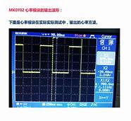 可以异地监控心率的智能手环品牌(可以实时监控心率的手环)