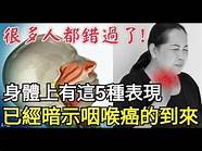 3·28咽喉健康日 本周日 协和专家义诊送健康