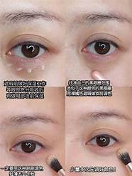 怎么样去除黑眼圈与黑眼圈