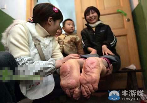 达人分享！双性人图片“星星点点”