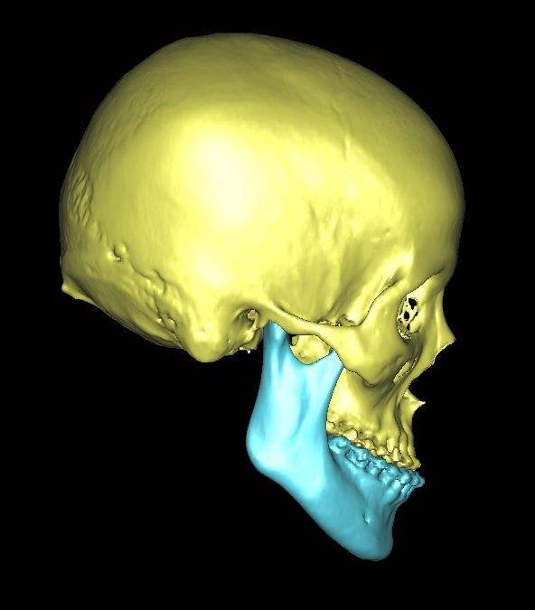 讲解！鞋拔子是什么“郢中白雪”