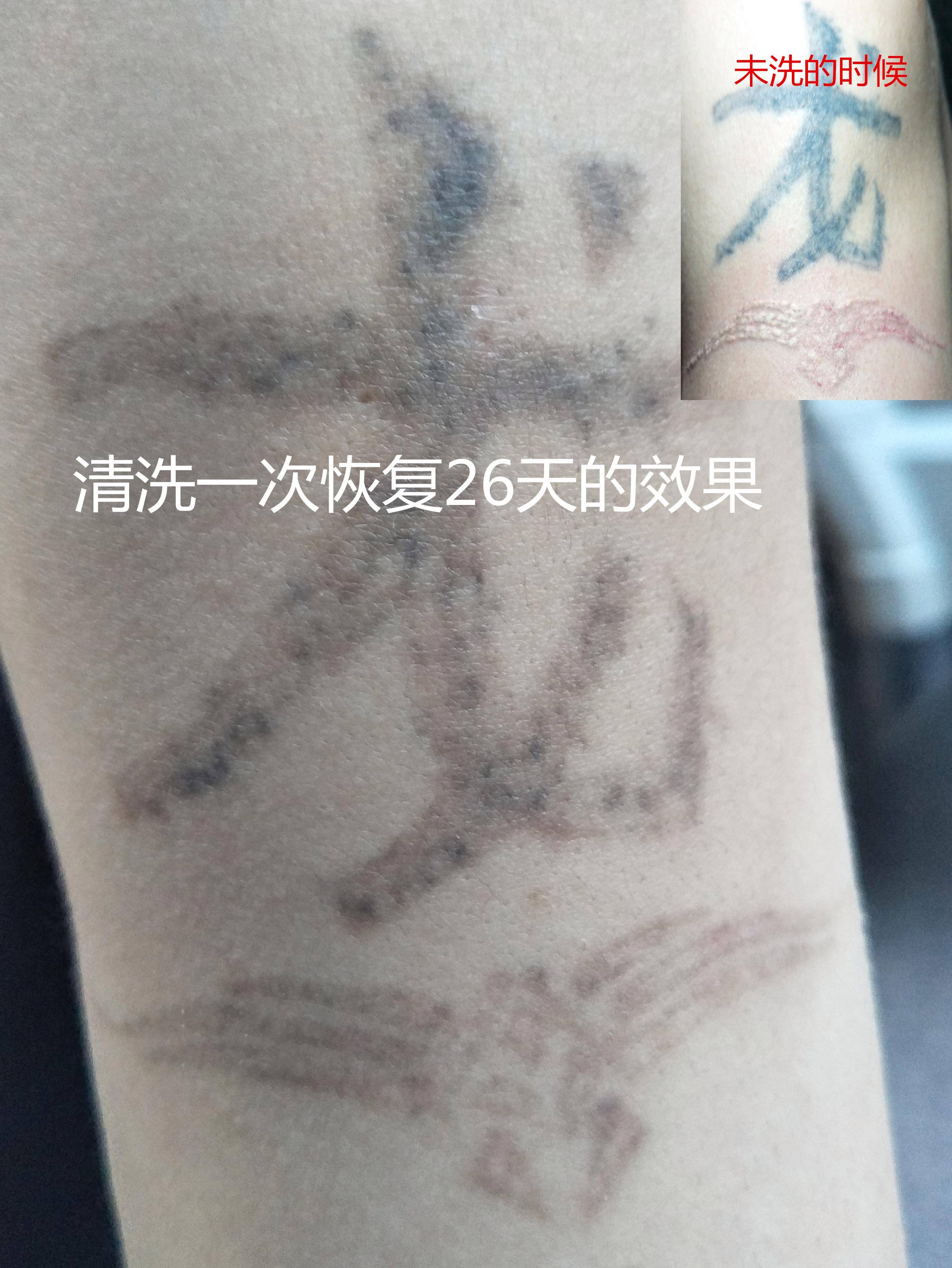 达人分享！清洗纹身的方法“纯一不杂”