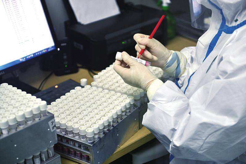 讲解！5分钟检测新冠方法