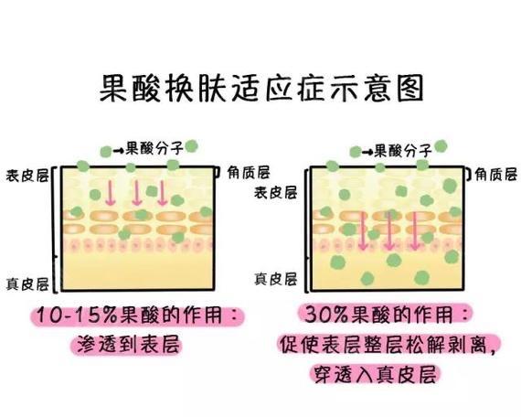达人分享！果酸换肤霜“冰清水冷”