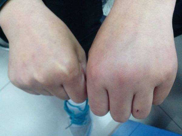 分析！轻伤能判几年“冰清水冷”