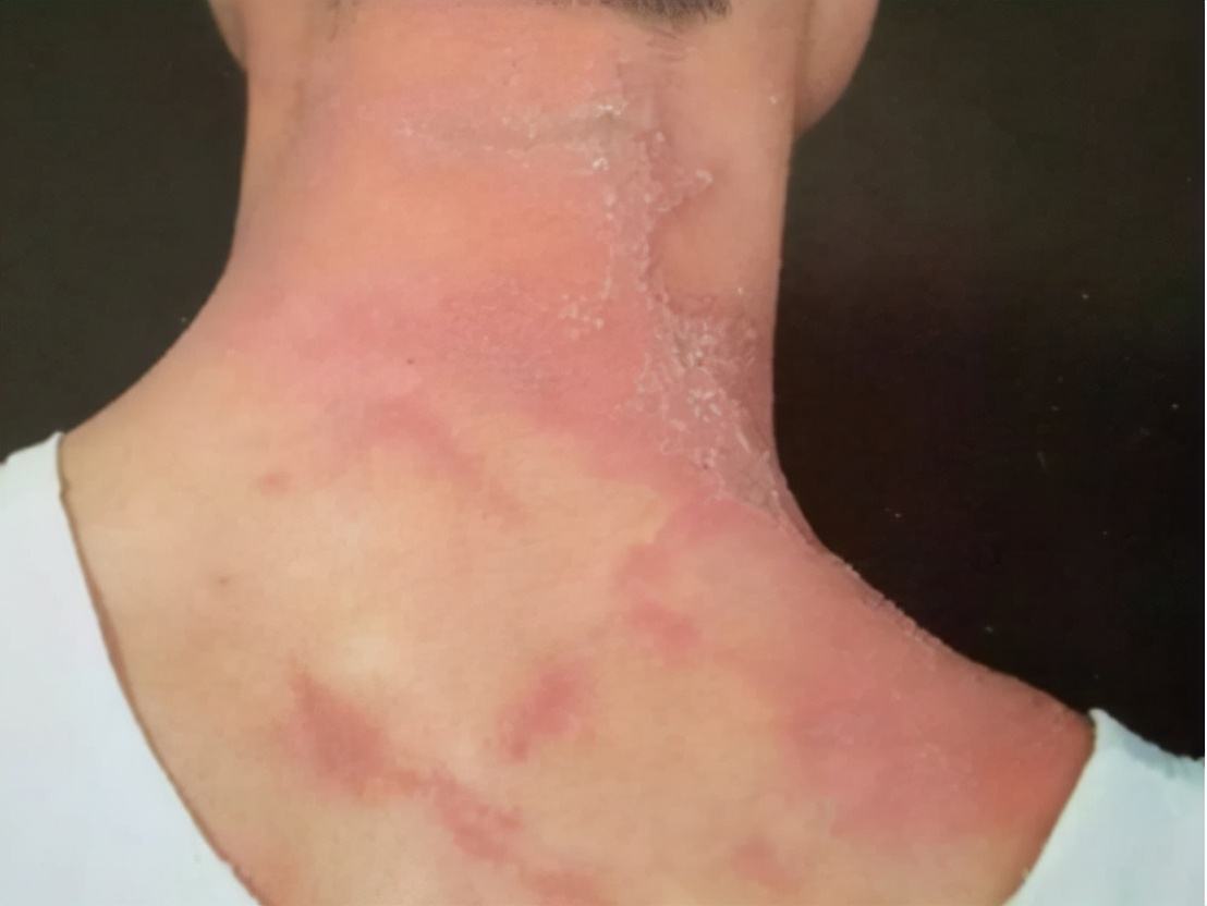 分析！隐翅虫主要分布在哪里