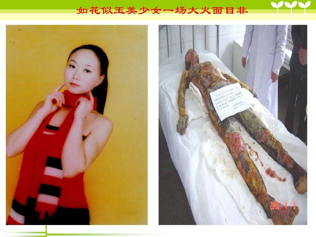 分析！小学生消防小常识十条“高情逸态”