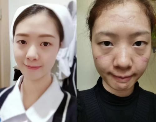 讲解！端木新卉的老公“夏花依旧”