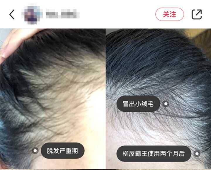 分析！霸王洗发水怎么样“高情逸态”