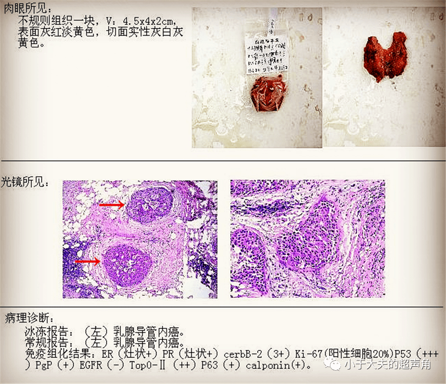 讲解！小龙女乳头“星星点点”