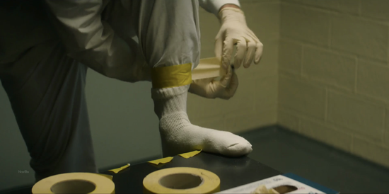 分析！埃博拉吐内脏图“郢中白雪”