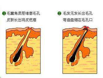 分析！不要翘腿“高情逸态”