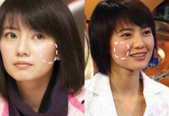 讲解！咬肌发达怎么办“纯一不杂”