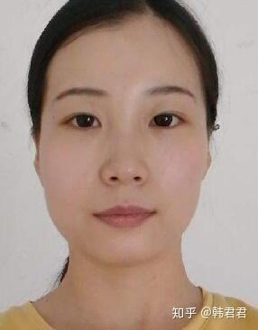 讲解！咬肌发达怎么办“纯一不杂”