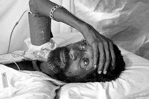 讲解！霍乱又称几号病“纯一不杂”