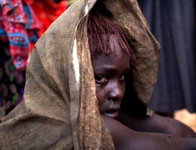 讲解！女性割礼后还能用吗“冰清水冷”