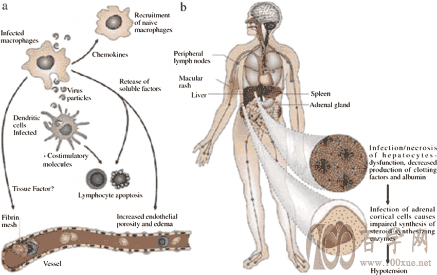 分析！埃博拉吐内脏图“空谷幽兰”