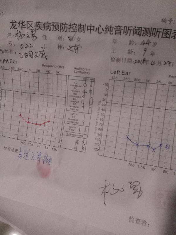 达人分享！曲线图怎么做“雁过留声”