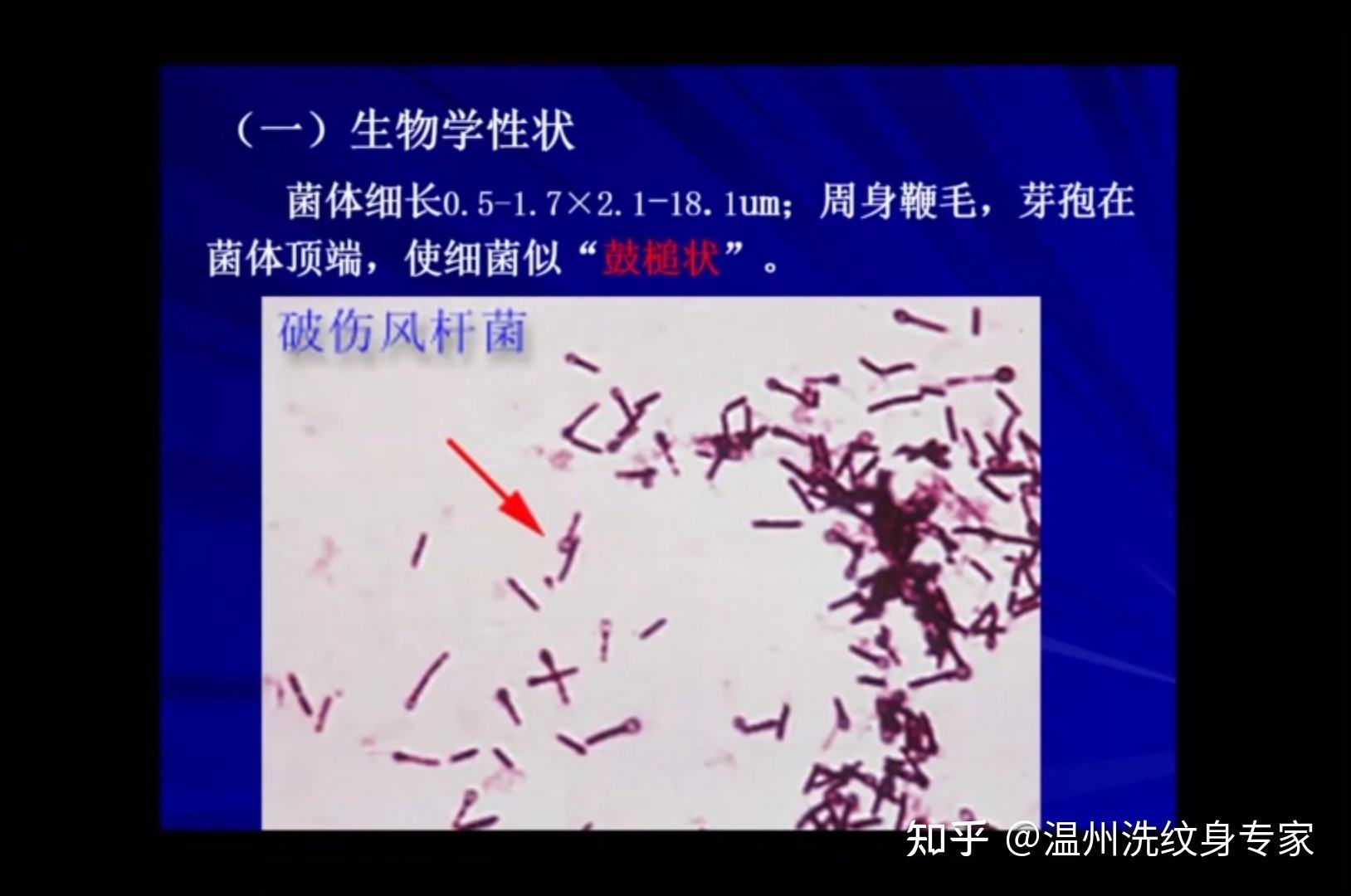 分析！清洗纹身的方法“雁过留声”