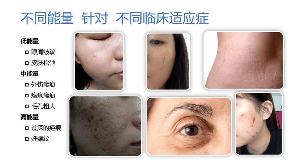 分析！清洗纹身的方法“雁过留声”