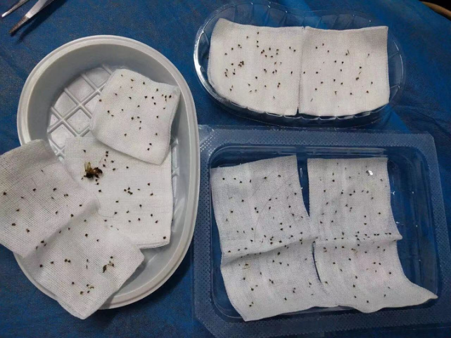 讲解！农妇被蜂群袭击“高情逸态”