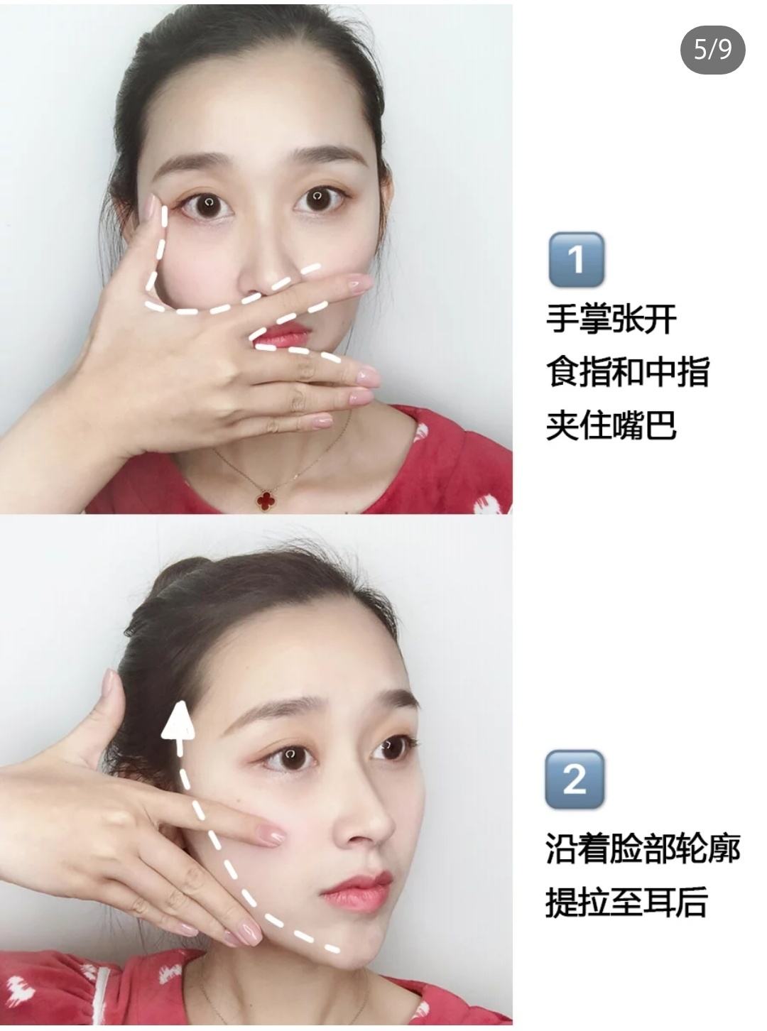 讲解！咬肌发达怎么办