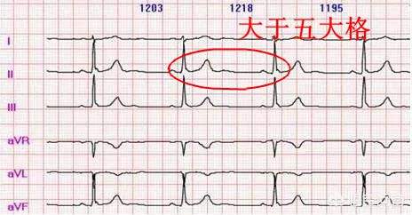 分析！心动心如“典则俊雅”