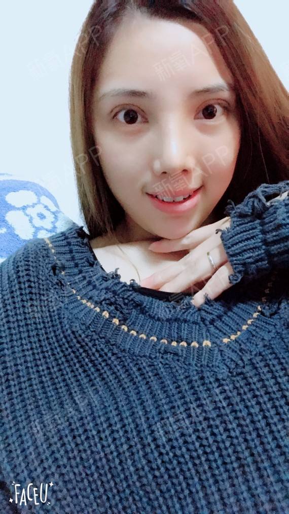 分析！眼睛充血怎么快速消除“星星点点”