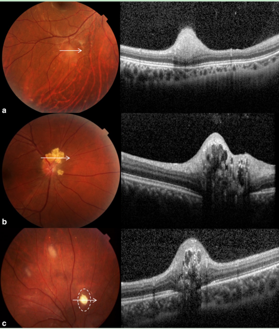 分析！视网膜屏幕是什么意思“空谷幽兰”