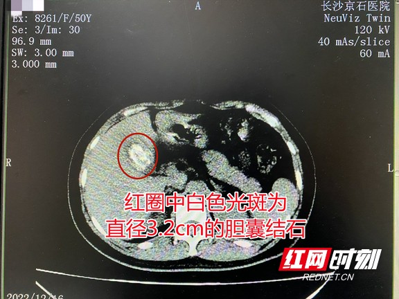 分析！50岁出轨女人的自白“星星点点”