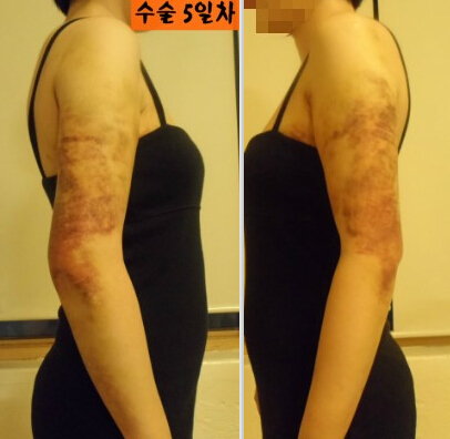 讲解！身体塑性