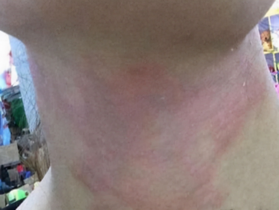 达人分享！隐翅虫主要分布在哪里“一抹红尘”