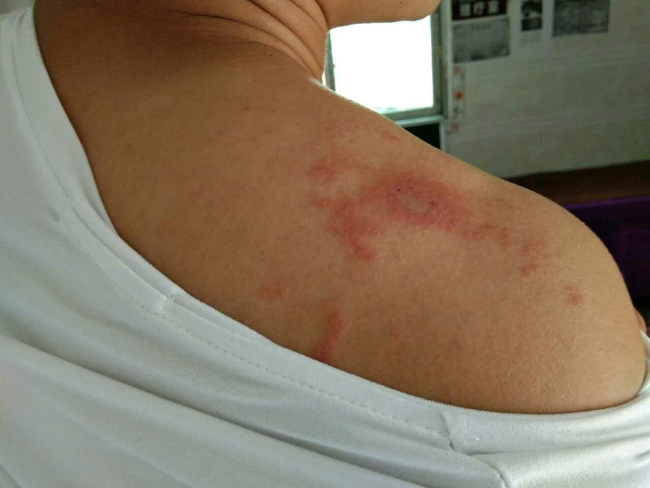 达人分享！隐翅虫主要分布在哪里