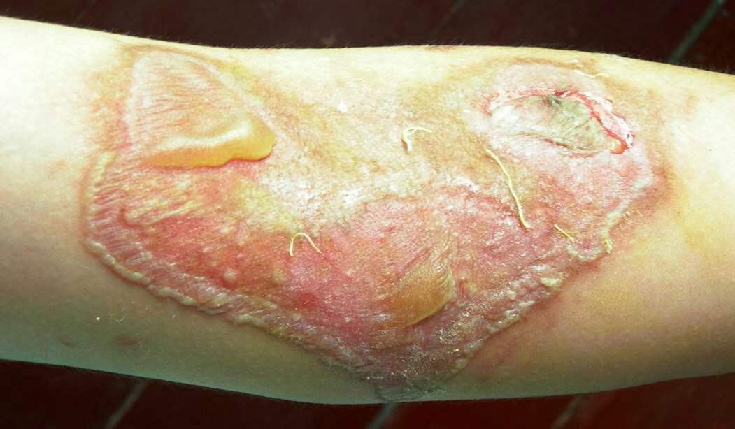 达人分享！隐翅虫主要分布在哪里