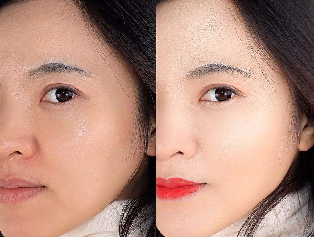 分析！眼睛充血怎么快速消除“郢中白雪”