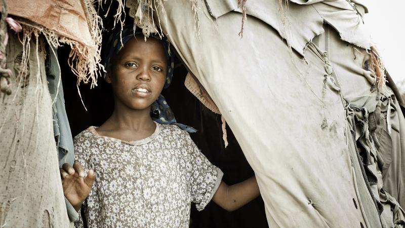 分析！女性割礼后还能用吗“雁过留声”