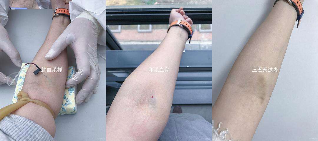 分析！封锁道路“高情逸态”